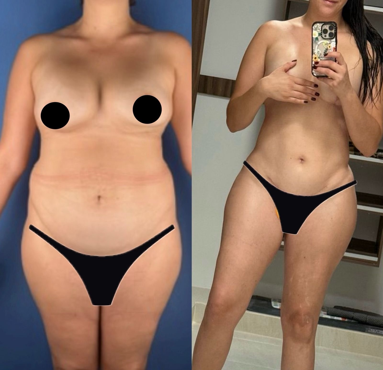 Before and after result 1